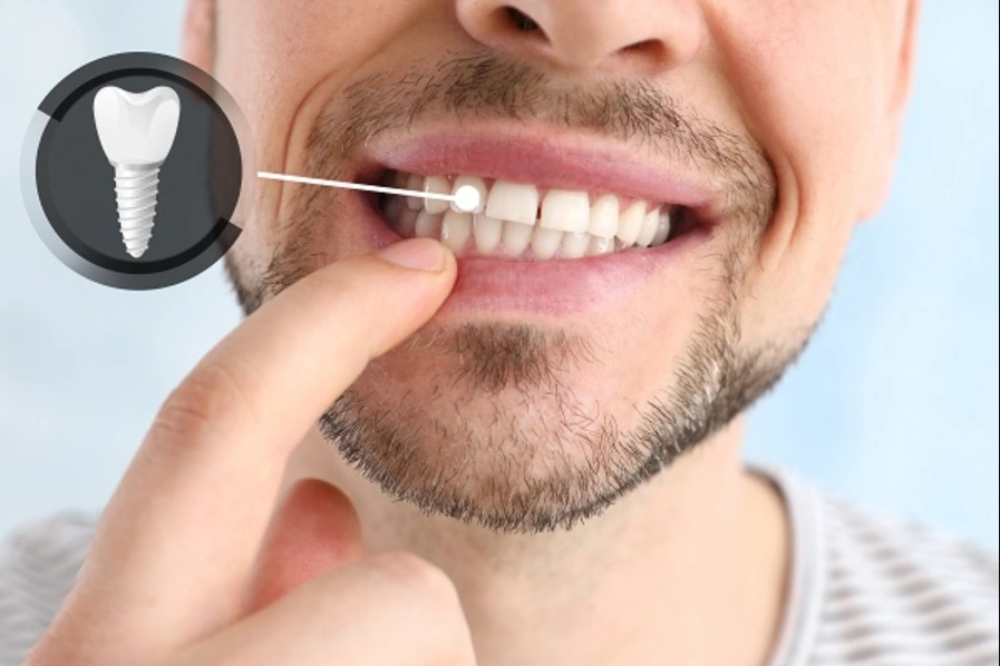 Chevy Chase Dental Care