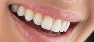 Roca Dental