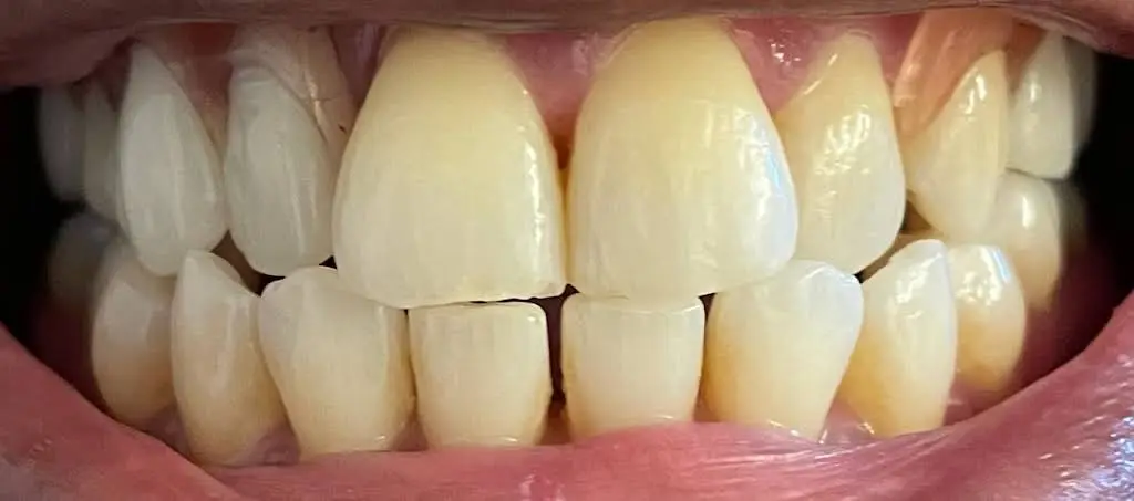 My Emergency Dental