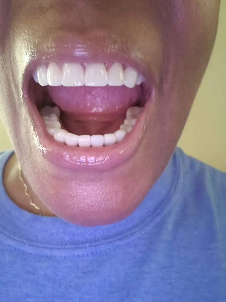 My Emergency Dental