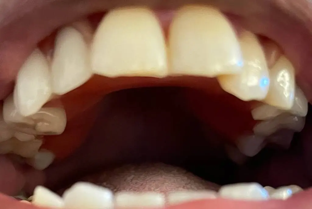 My Emergency Dental