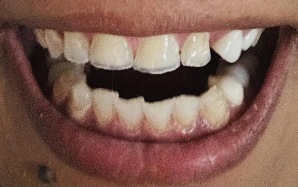 Dental One Associates at Eagles Landing