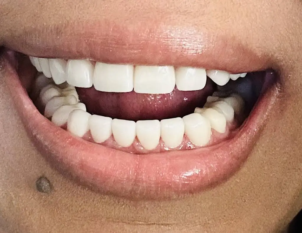 Dental One Associates at Eagles Landing