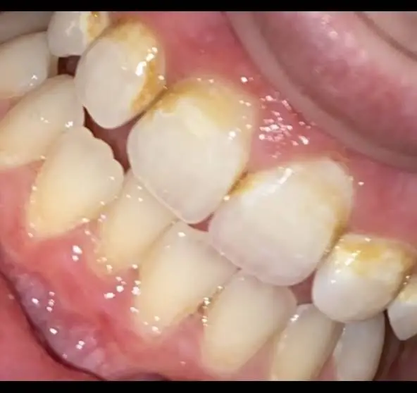 Dental Group South, Inc.