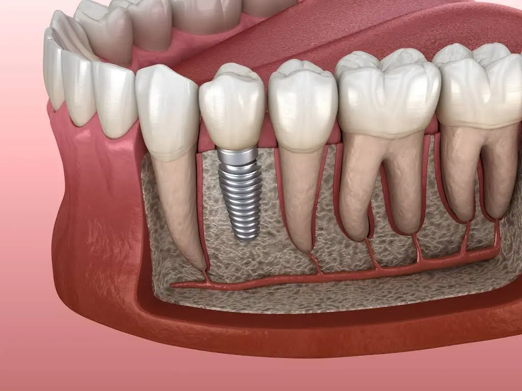 Precision Oral Surgery and Implants