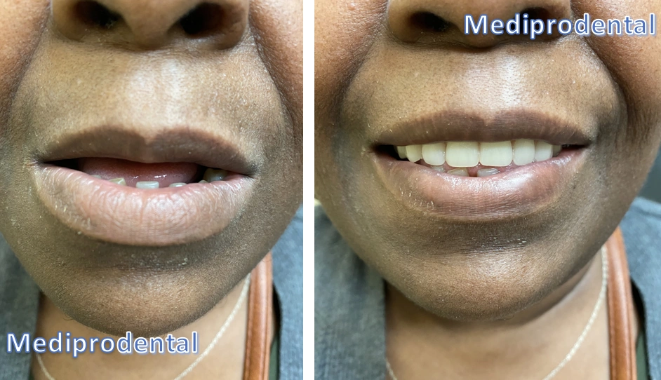 Mediprodental