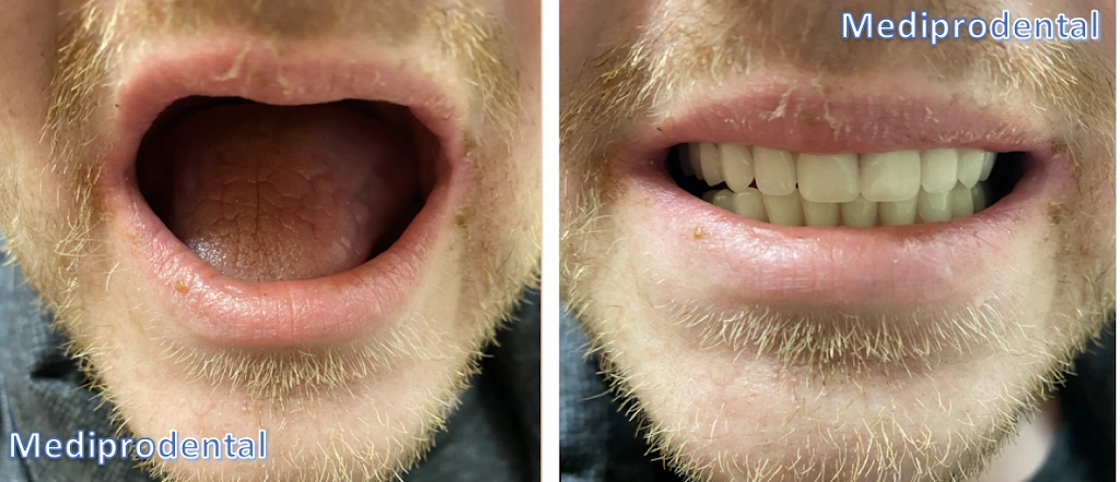 Mediprodental