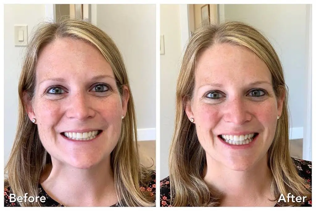Algonquin Dental Associates