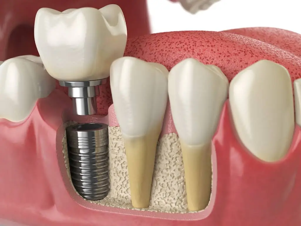 Brimfield Family Dentistry