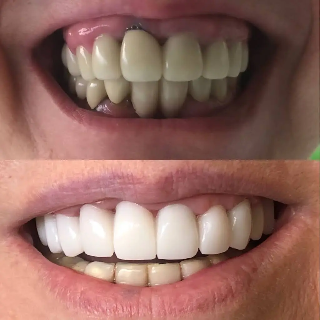 Lincoln Cosmetic Dentistry
