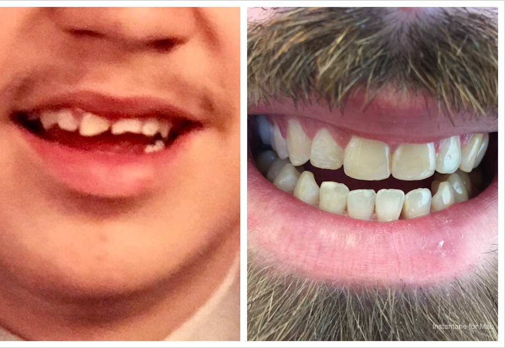 Lincoln Cosmetic Dentistry