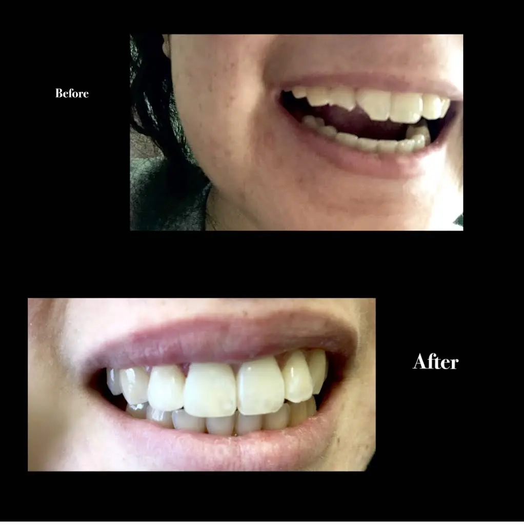 Lincoln Cosmetic Dentistry