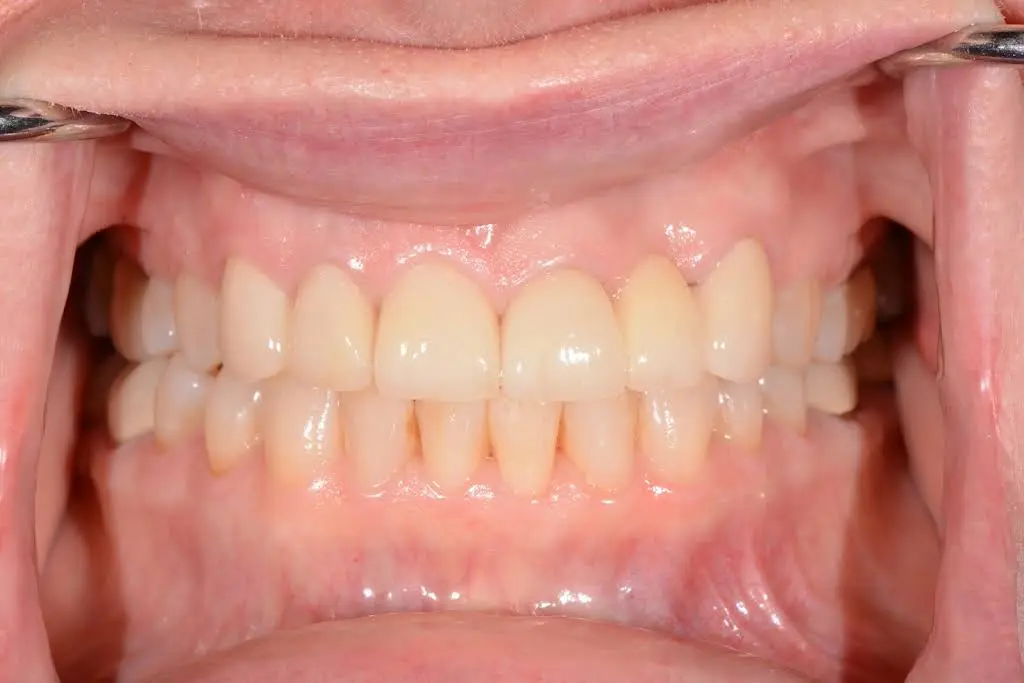 Lux Smiles Cosmetic Dentistry and Prosthodontics