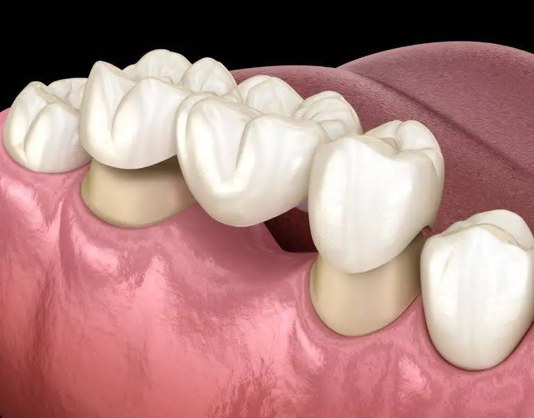 Park West Dental