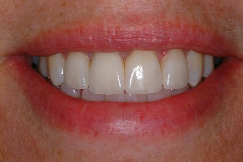 Evanston Dental Associates