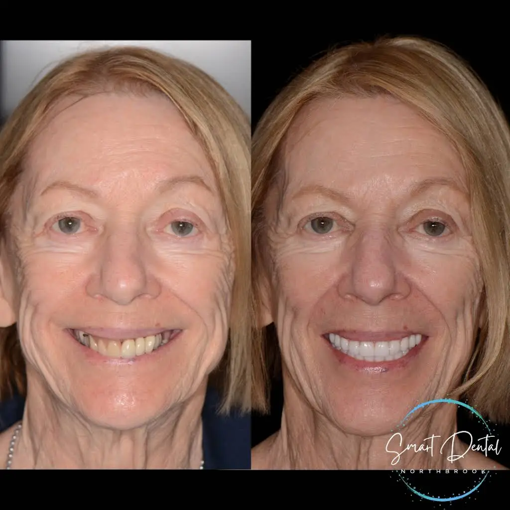 Smart Dental Cosmetic Dentistry and Prosthodontics