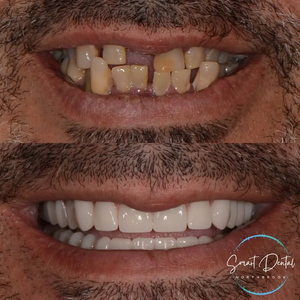 Smart Dental Cosmetic Dentistry and Prosthodontics