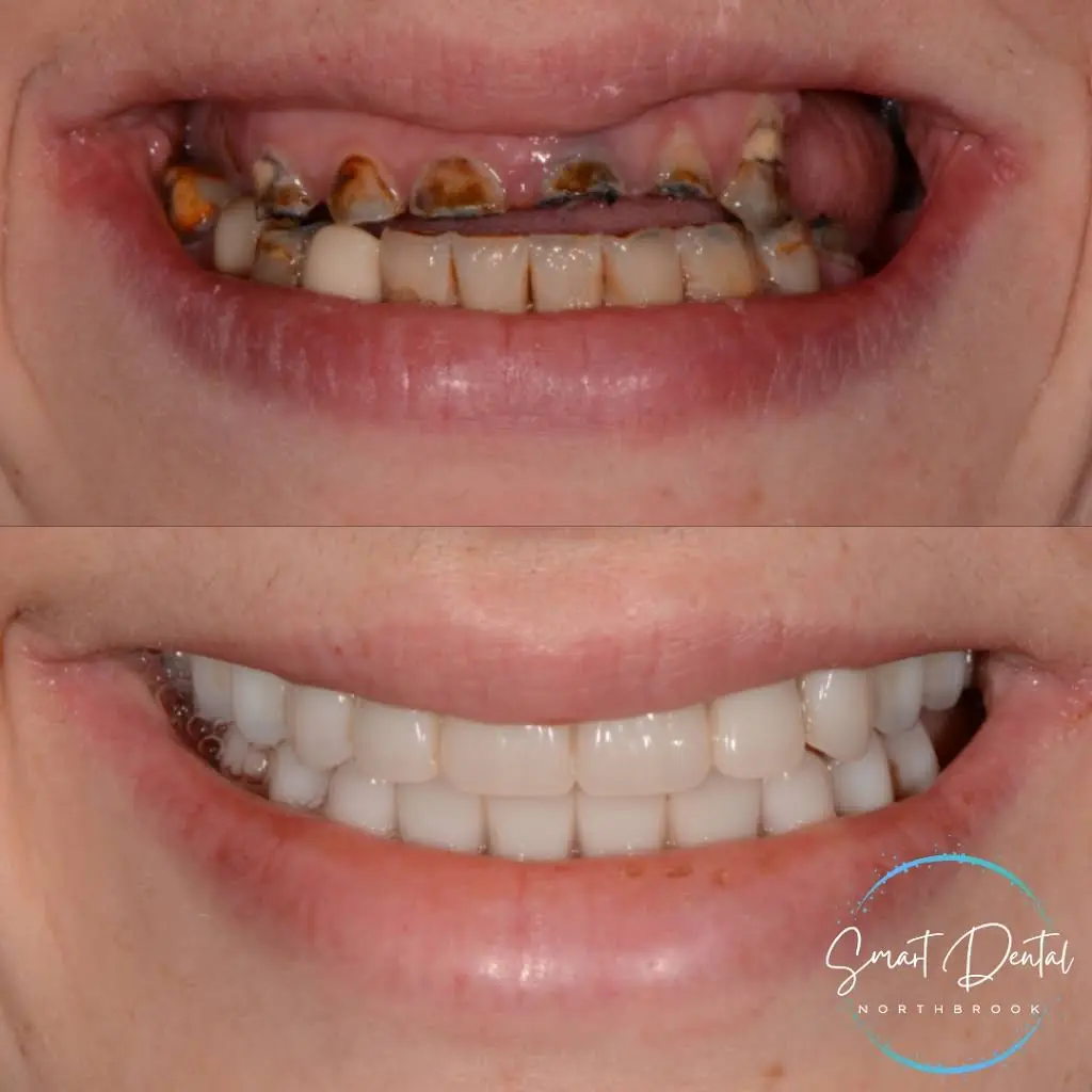 Smart Dental Cosmetic Dentistry and Prosthodontics