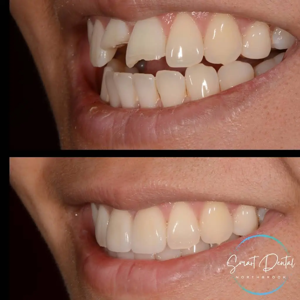 Smart Dental Cosmetic Dentistry and Prosthodontics