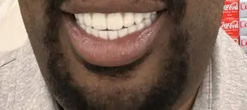 D5teeth - Chicago