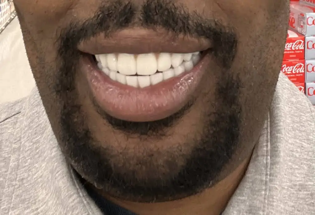 D5teeth - Chicago