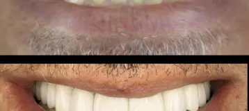 Allure Dental Chicago