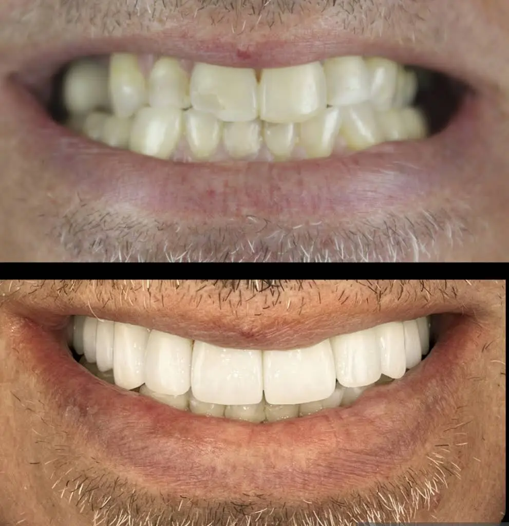 Allure Dental Chicago