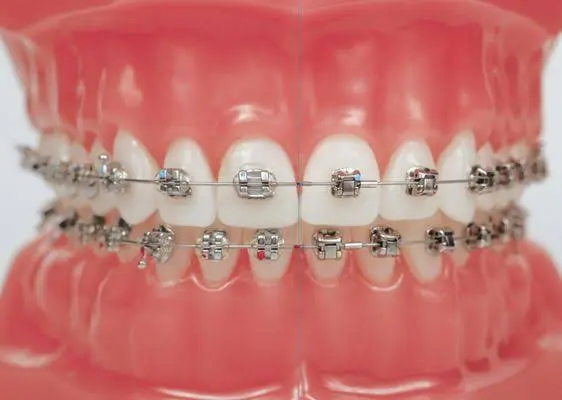 MetroSmiles Dental