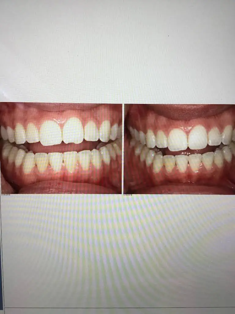 Family Dental Care - Evergreen Park