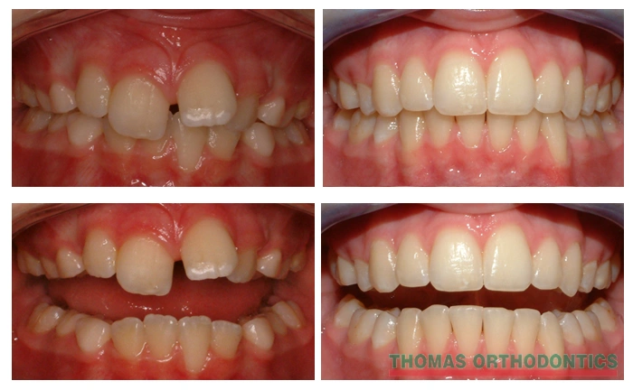 Thomas Orthodontics