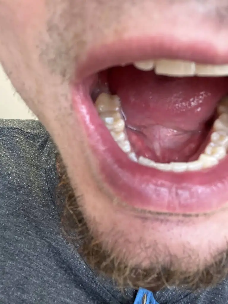 Naperfield Endodontics