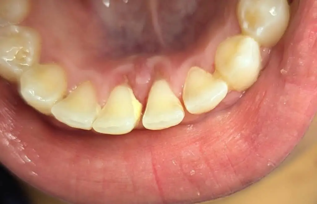 Dental Dreams