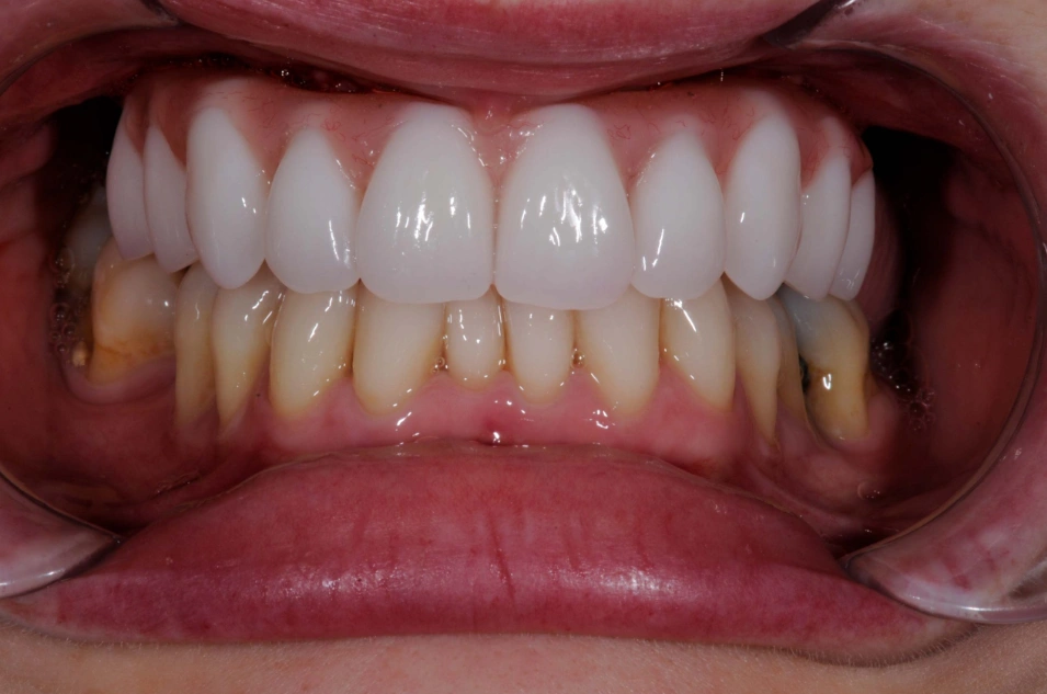 Health 360 Dental