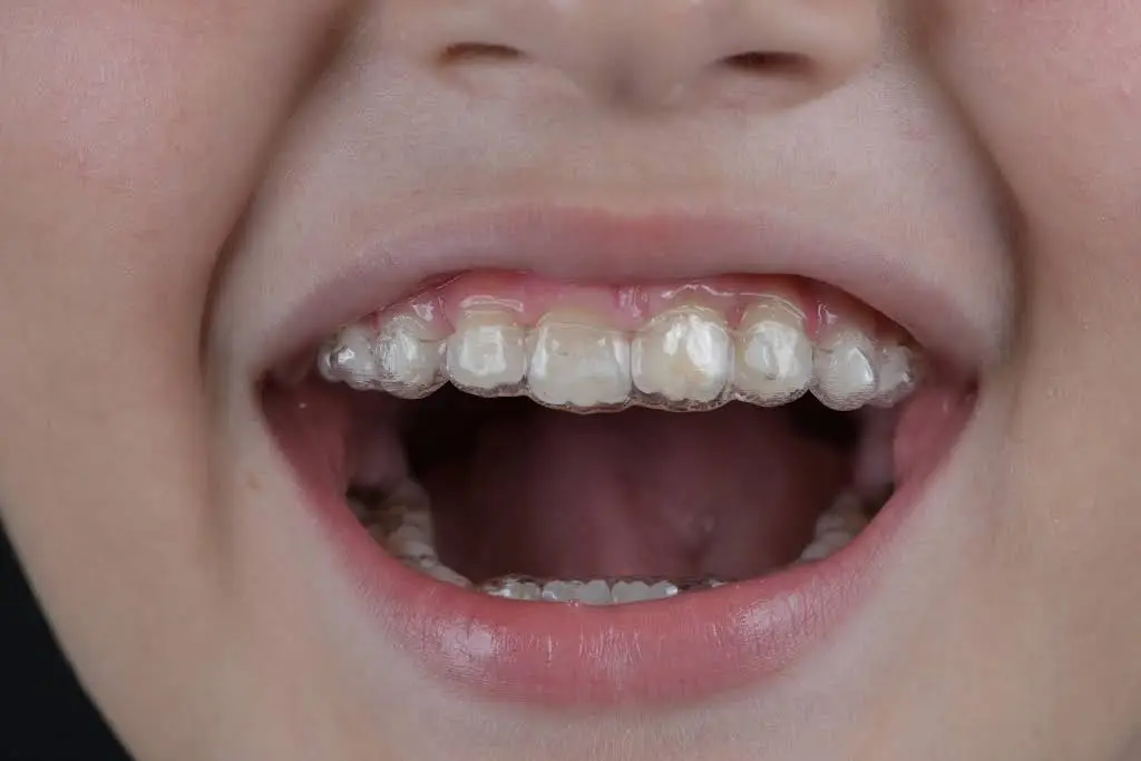 Orthodontics at Serenbe
