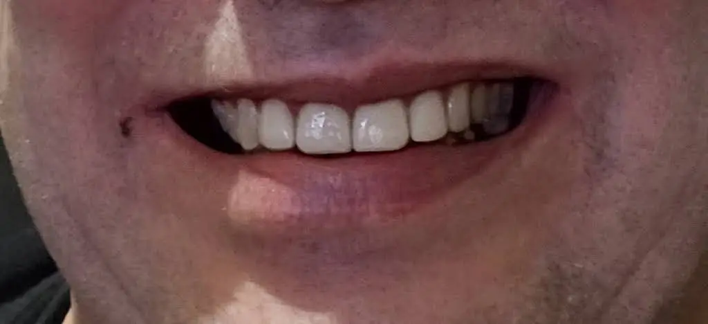 Thomas Crossroads Dental Center: Frank Huff Jr., DMD & Bryan Scalf, DDS