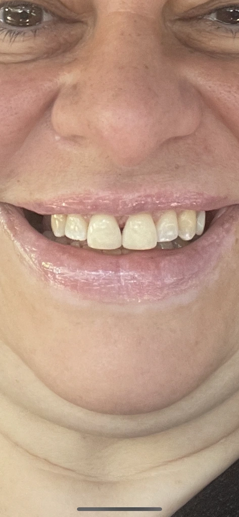 Mark W. Jacob, DDS, PC