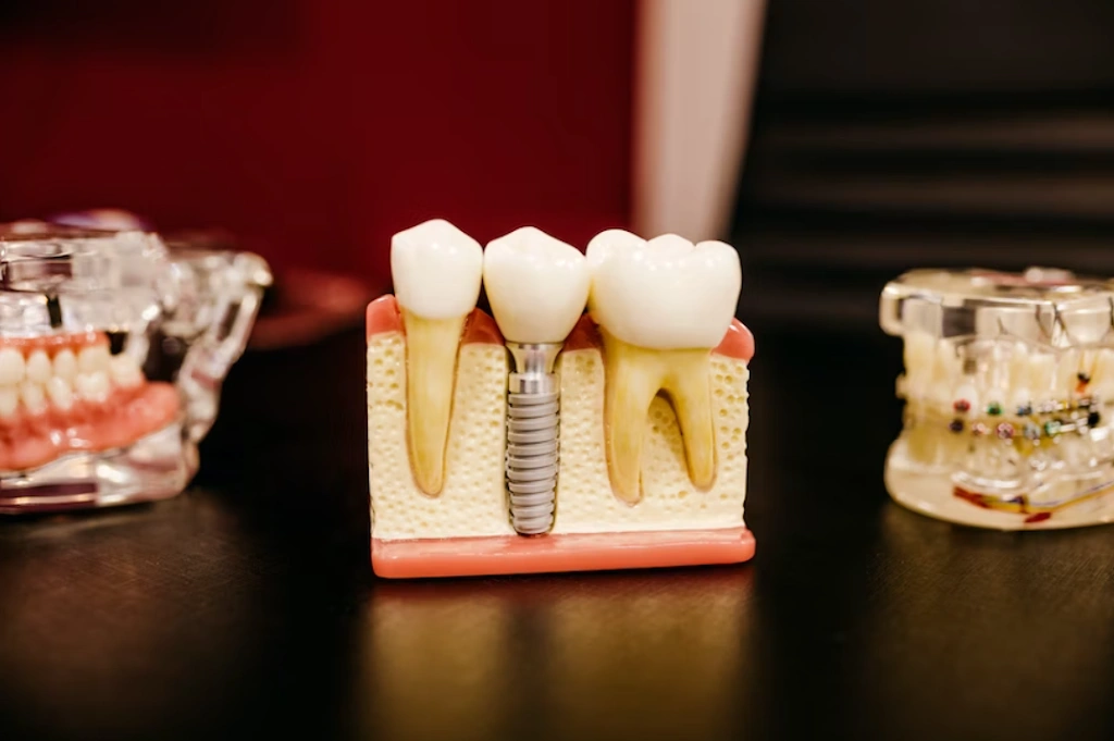 Kimes & Bohl Dental Center