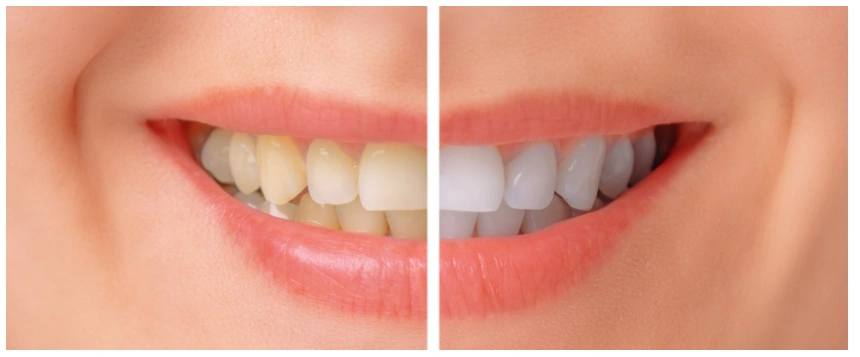 Mundelein Dental Center