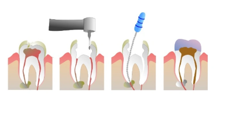 Mundelein Dental Center
