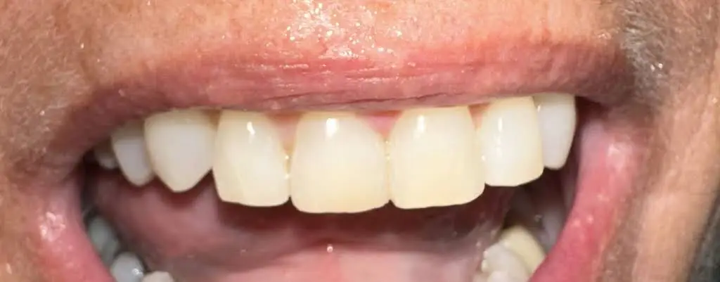 Cornerstone Family Dentistry - Morrison