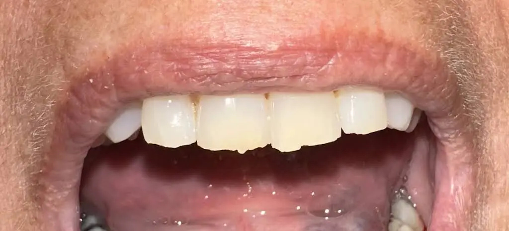Cornerstone Family Dentistry - Morrison