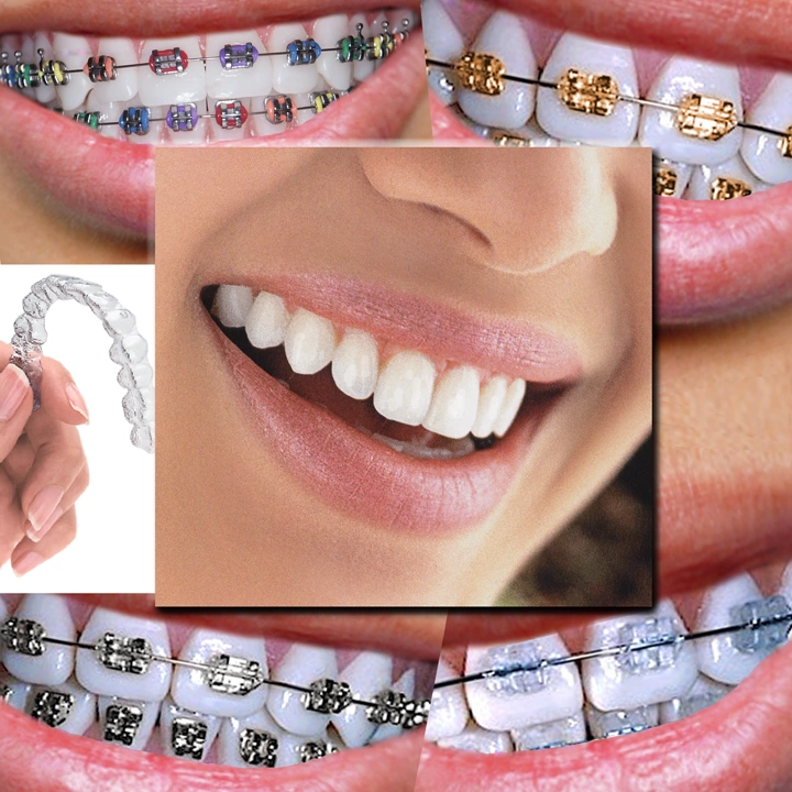 Ladner and Jain Orthodontics, LLP