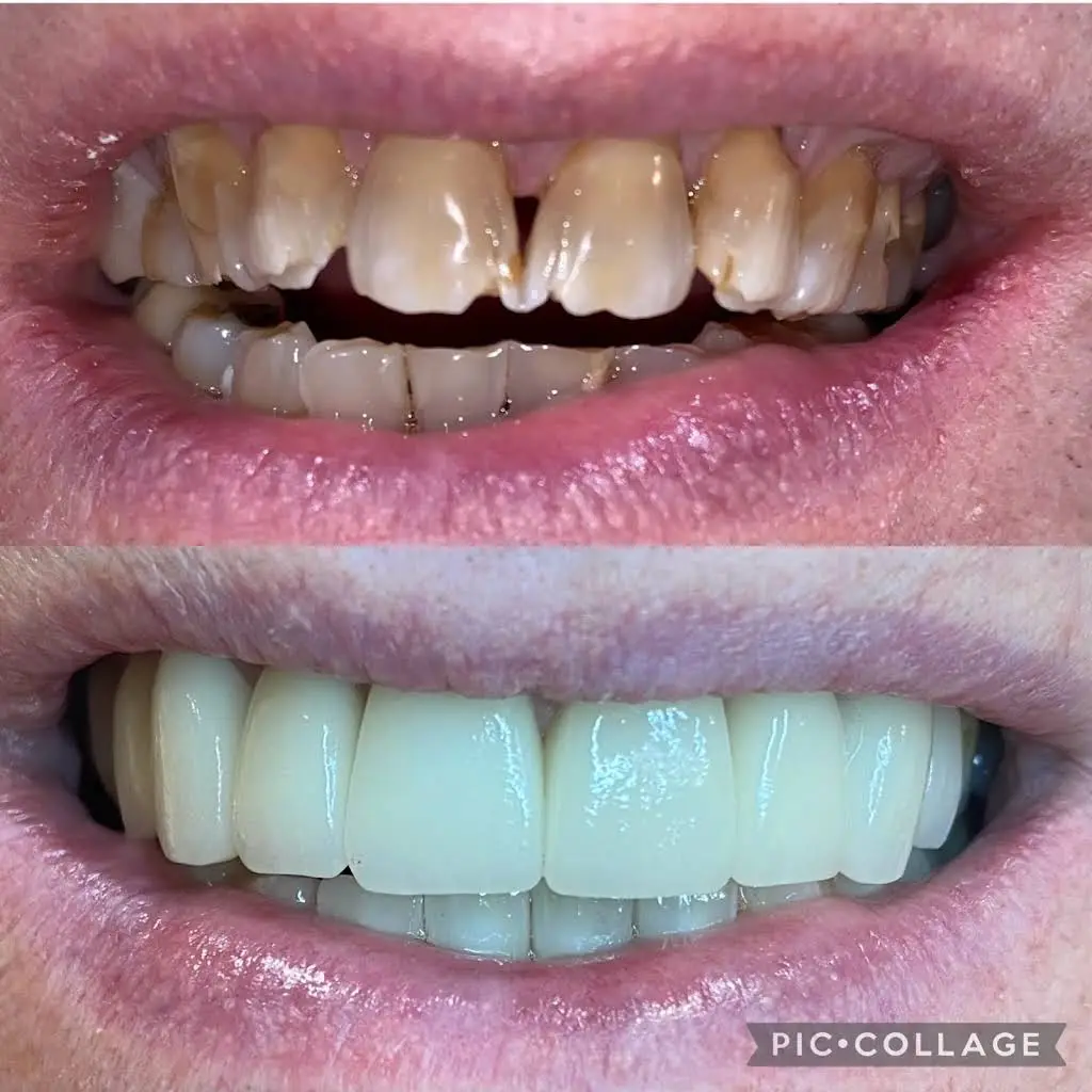 Wilmette Dental