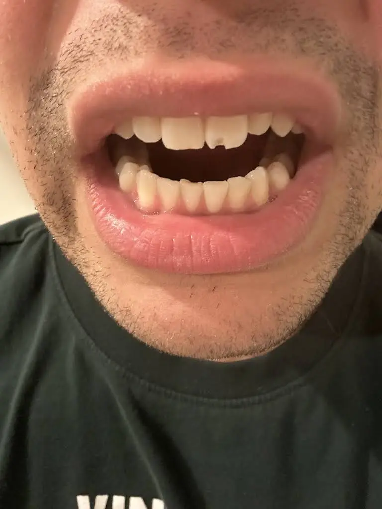 Smilin Dental