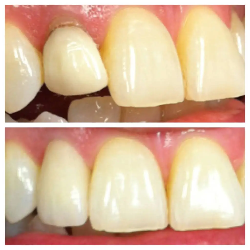Alan Robbins DDS