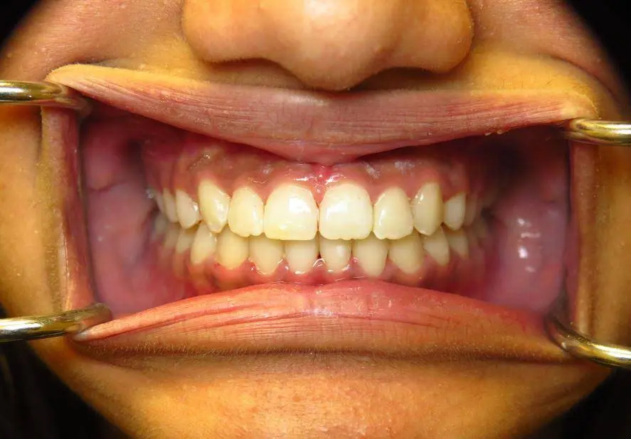 Comfort Family Dental