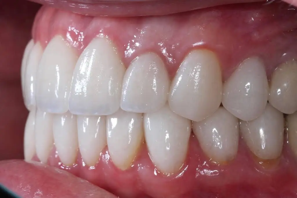 Pinnacle Dental Group
