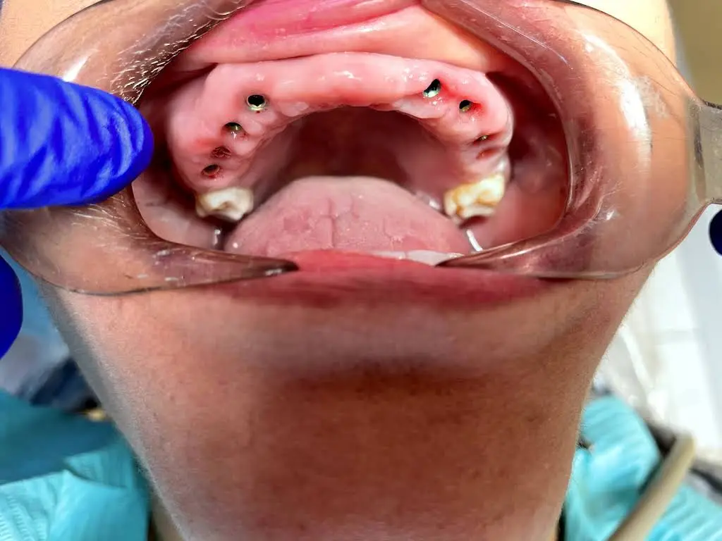Centro Dental Las Americas