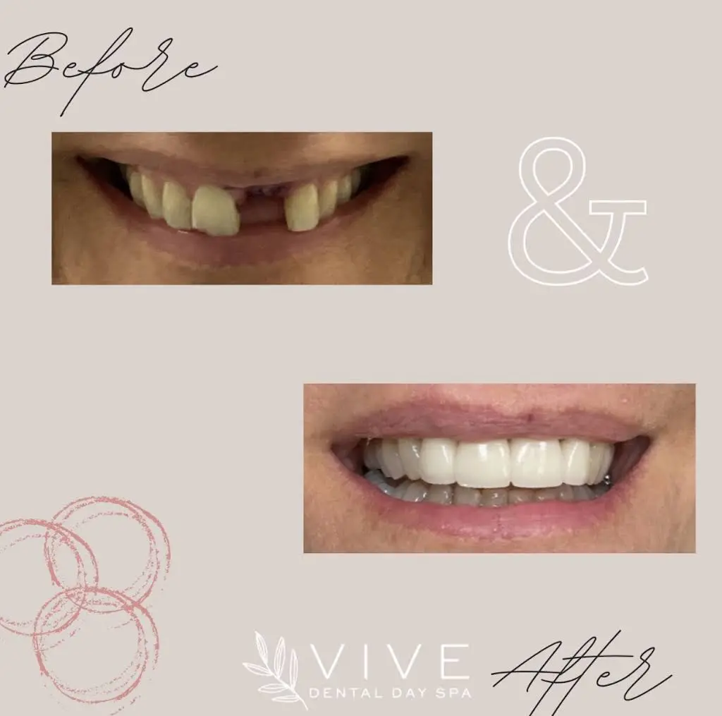 Vive Dental Day Spa