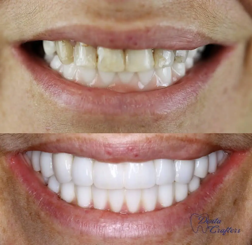 DentaCrafters PLLC